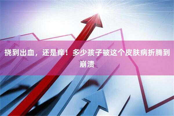 挠到出血，还是痒！多少孩子被这个皮肤病折腾到崩溃